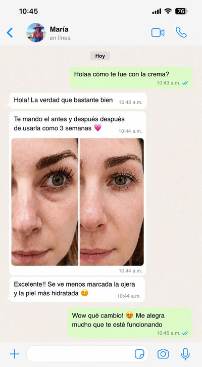 RetinalShot - testimonio María antes y después